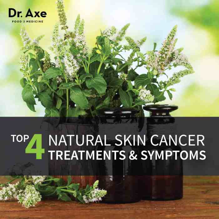 The Risk of Alternative Cancer Treatments - The New York Times